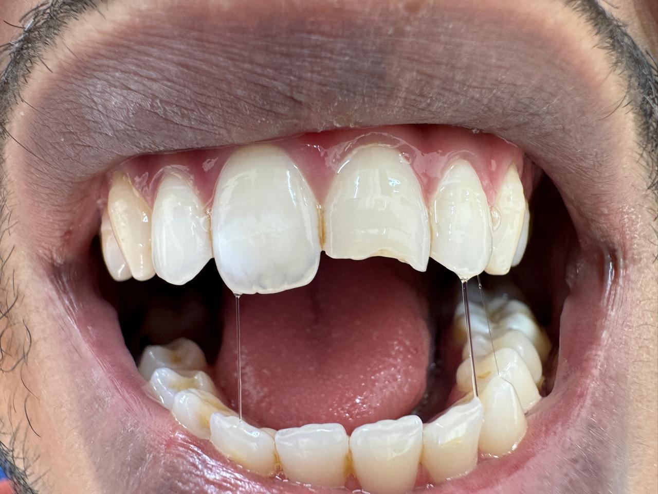 Aesthetic reshaping before treatment